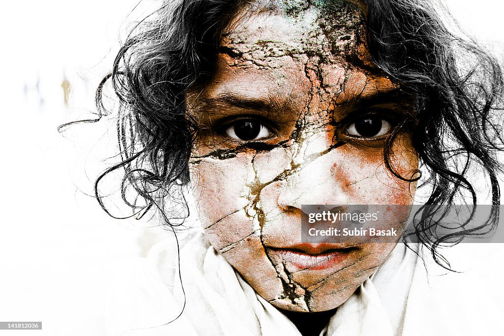 Girl with cracked skin