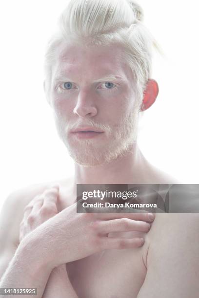 portrait of young albino man on white isolated background. beautiful serious man with white lashes, brows, beard, grey eyes and silver white hair. - long hair stock photos et images de collection