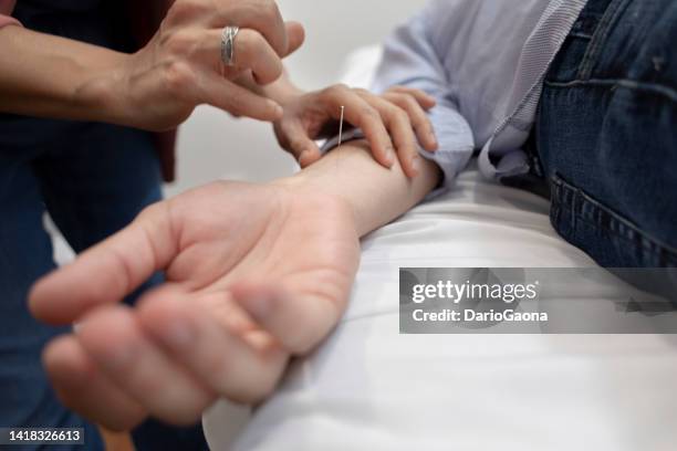 woman giving therapy to man - acupuncture stock pictures, royalty-free photos & images