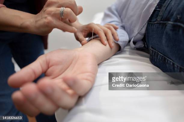 mulher dando terapia ao homem - acupuncture - fotografias e filmes do acervo