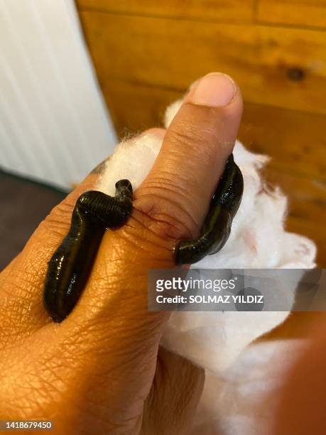 leech therapy - leech stock pictures, royalty-free photos & images