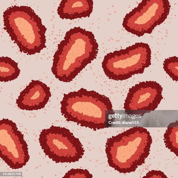 cartoon style monkey pox seamless pattern - skin problem stock illustrations