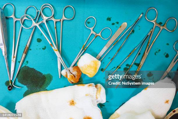 medical equipment on table in emergency room - equipamento cirúrgico imagens e fotografias de stock