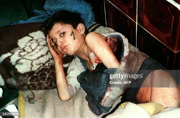 Poorly nourished and wounded Bosnian child lies on a makeshift hospital bed waiting for his evacuation from Srebrenica in this picture taken in april...