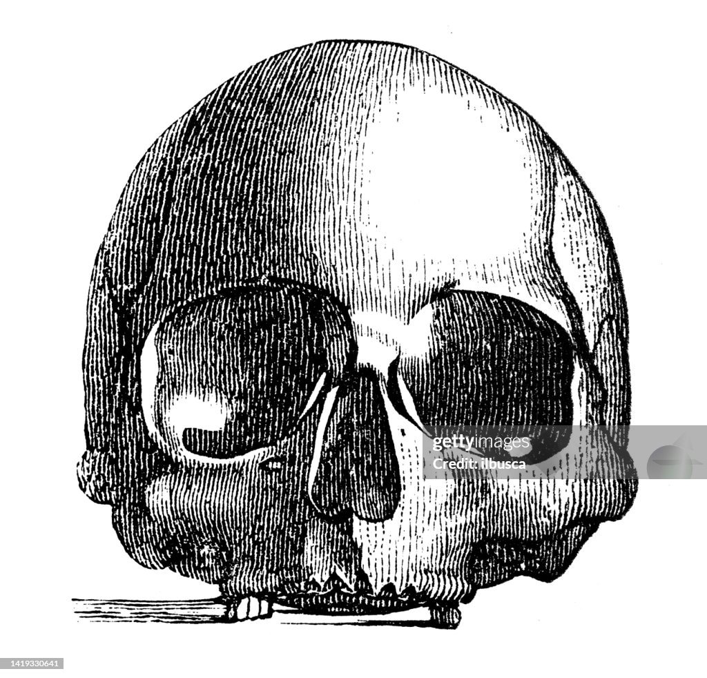 Antique illustration, ethnography and indigenous cultures: Kotzebue, Alaska skull