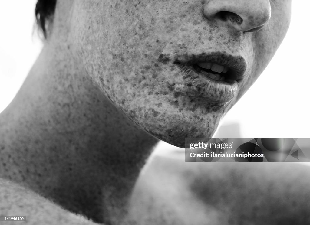 Girl with freckles