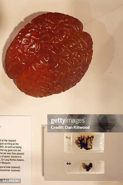 Slices of Albert Einstein's brain are displayed at the Wellcome trusts new 'Brains' exhibition at the Wellcome Collection on March 27, 2012 in...
