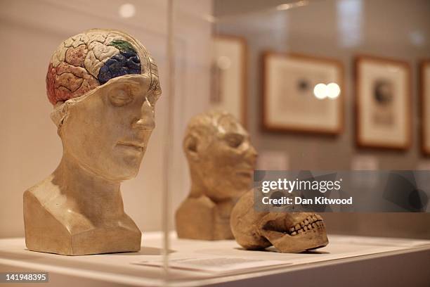 Skull is displayed at the Wellcome trusts new 'Brains' exhibition at the Wellcome Collection on March 27, 2012 in London, England. The exhibit makes...