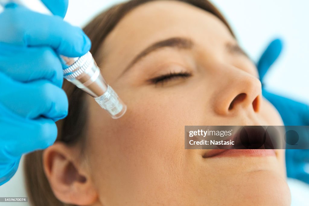 Close up ,dermapen skin needling treatment on a patient skin