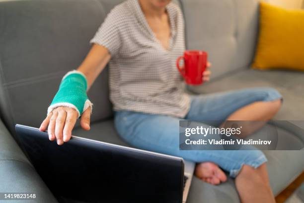 woman with broken arm drinking coffee while looking at laptop - broken laptop stockfoto's en -beelden