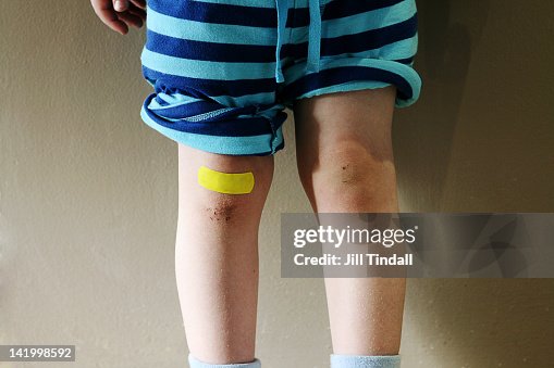 Bruised Knees Bruised Knees