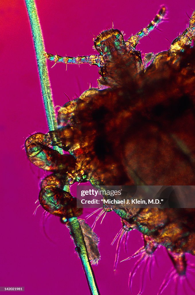 Close up of crab louse on hair