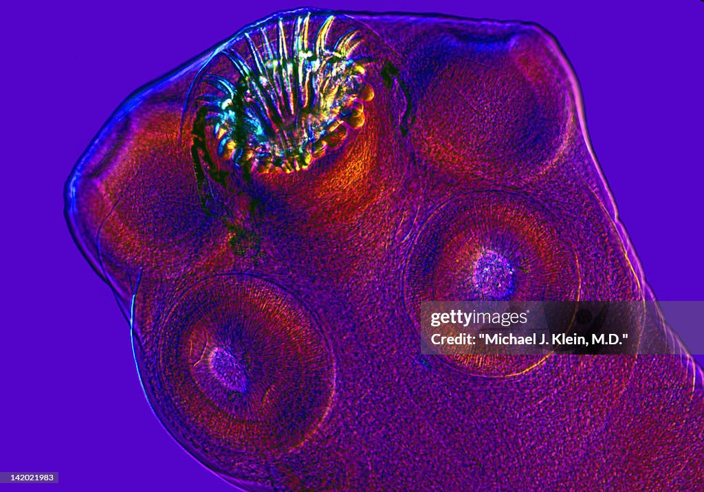 Head of pork tapeworm