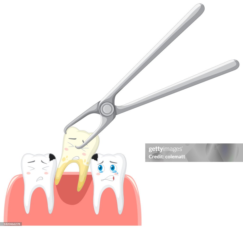 Tooth Extration Cartoon Cartoon Teeth Extraction On White Background High-Res Vector Graphic ...