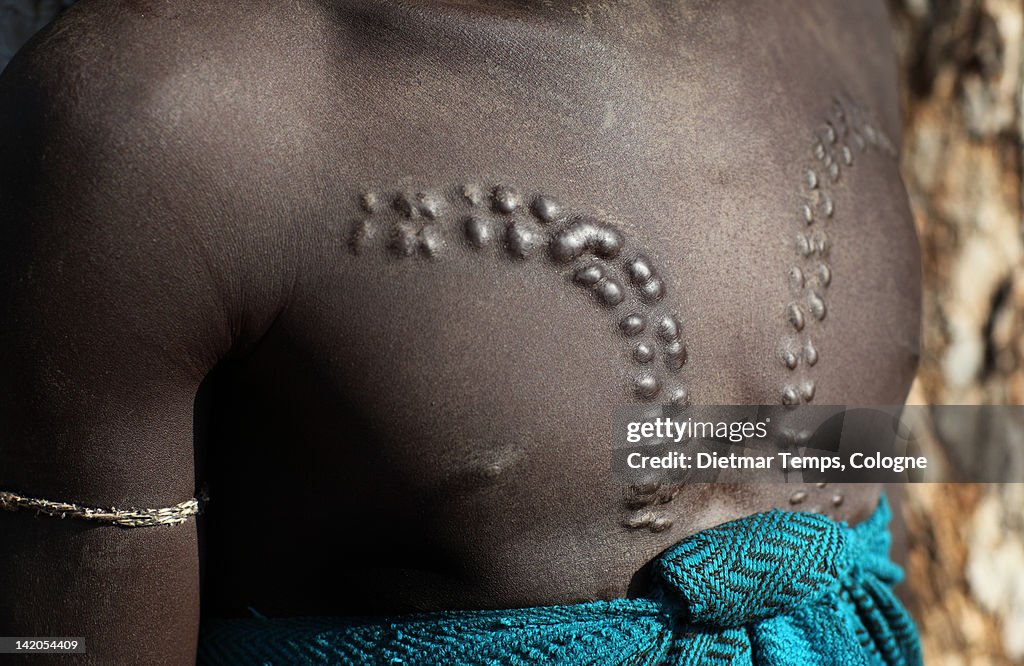 Close-up of scarification on chest