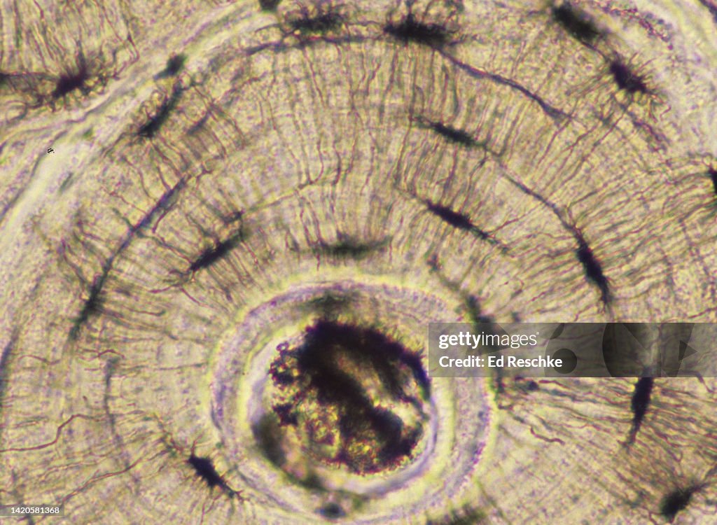 Close-up of an OSTEON (or Haversian System), shows CANALICULI, LACUNAE, OSTEONIC CANAL, 200X