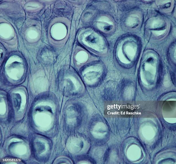 elastic cartilage--elastic fibers, chondrocytes, lacunae, matrix, 250x - elastisch weefsel stockfoto's en -beelden