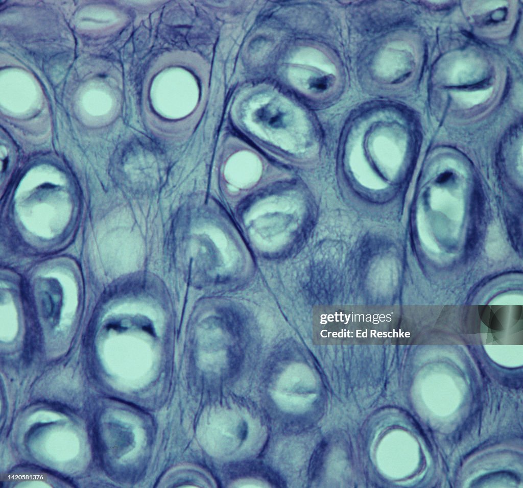ELASTIC CARTILAGE--Elastic Fibers, Chondrocytes, Lacunae, Matrix, 250X