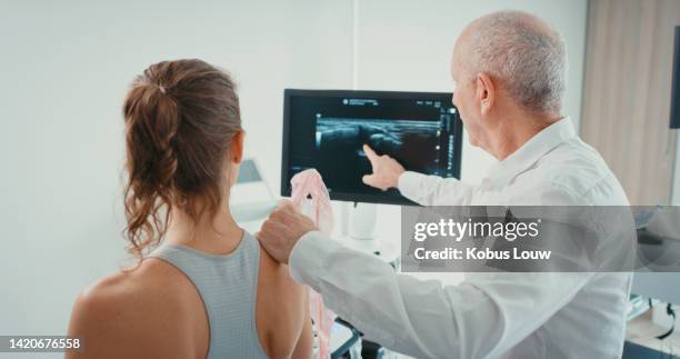 medico, consulenza ed esame medico su lesione alla spalla, effettuato da operatore sanitario in ospedale o in clinica. tecnico di medicina, chirurgia e reumatologia che lavora con apparecchiature per la scansione a raggi x sulla donna - spalla foto e immagini stock