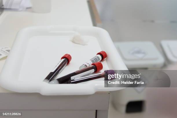 lavender ("purple") vacutainer test tube edta (chelator / anticoagulant) - provetta per campioni ematici foto e immagini stock