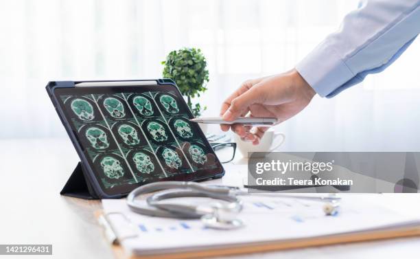 surgeons examining x-ray human brain scans in a neurology clinic at hospital. - skull xray no brain stock pictures, royalty-free photos & images
