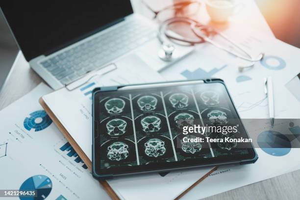 close-up of a digital tablet with brain x-ray on screen. - medical equipment fotografías e imágenes de stock