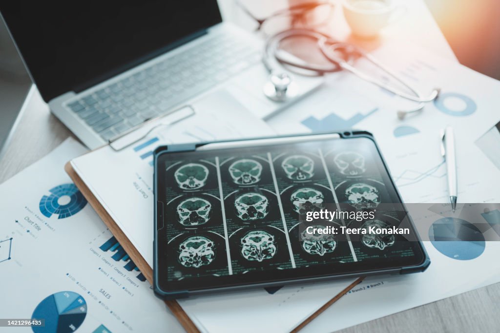 Close-up of a digital tablet with brain x-ray on screen.