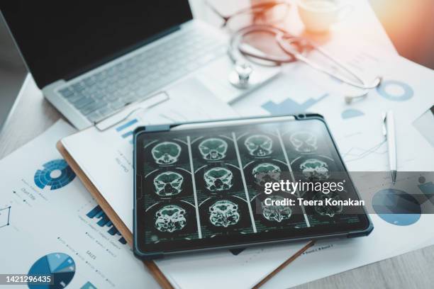 close-up of a digital tablet with brain x-ray on screen. - demens bildbanksfoton och bilder