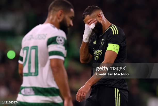 Karim Benzema of Real Madrid reacts after picking up an injury during the UEFA Champions League group F match between Celtic FC and Real Madrid at...