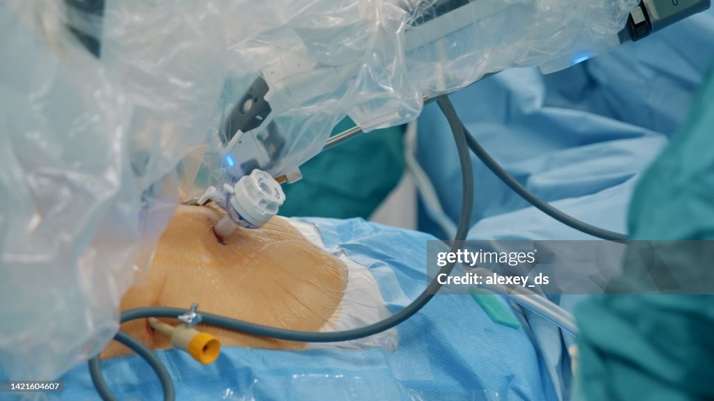 Addome del paziente con bracci robotici all'interno dell'addome