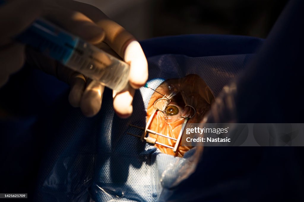 Close up of ophthalmic surgeon hand performing an eye surgery at the hospital