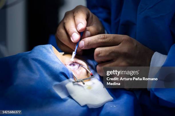 sealing lasik surgery - eye doctor stock pictures, royalty-free photos & images