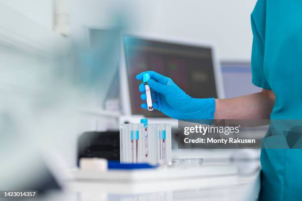 close-up of dental nurse with blood samples for testing in dental surgery - blood test stock pictures, royalty-free photos & images