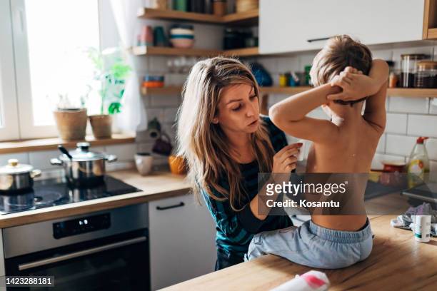 the unrecognizable boy sits quietly while his mother applies the medicine against chickenpox - gordelroos stockfoto's en -beelden