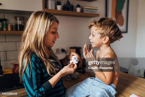 a woman applies medication to her four-year-old son who has chickenpox all over his body - bältros bildbanksfoton och bilder