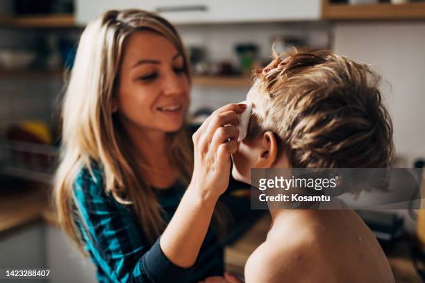 waist-up view of a smiling mother applying chickenpox medicine to her son - chickenpox 個照片及圖片檔
