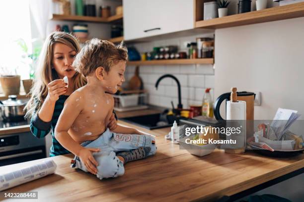 a millennial woman and her smiling son who has chickenpox spend the day at home - chickenpox stock pictures, royalty-free photos & images