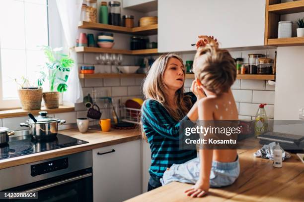 a mother carefully applies chickenpox medicine to her son, making sure to apply the medicine over each polka dot - measles stock pictures, royalty-free photos & images