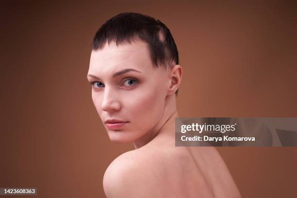 a young woman with alopecia. hair loss problem, young shirtless  women with baldness is looking at camera on beige background. the concept of human support, female power - queda de cabelo imagens e fotografias de stock