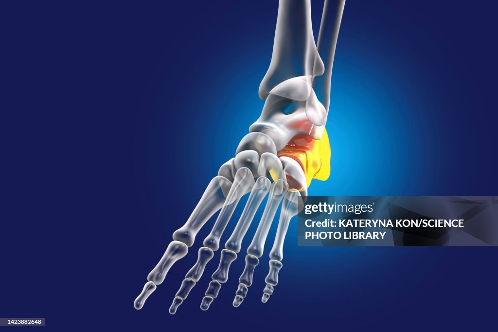 Calcaneus Bone Calcaneus Bone Illustration High-Res Vector Graphic - Getty Images