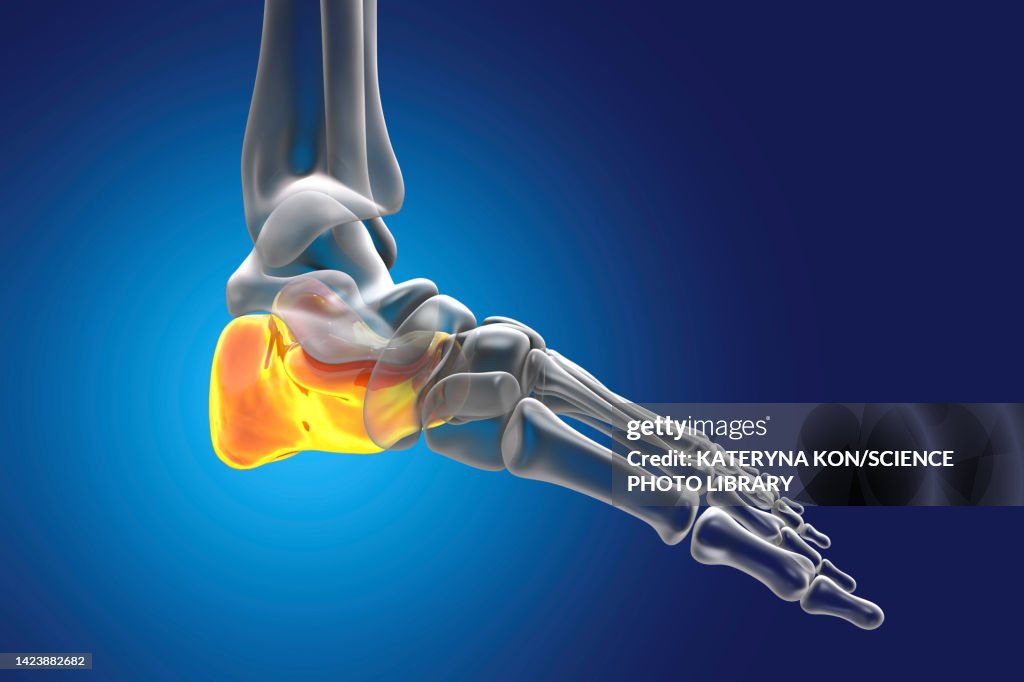 Calcaneus Bone Calcaneus Bone