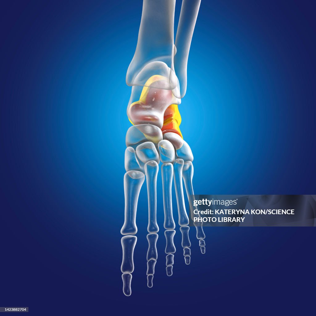 Calcaneus Bone Calcaneus Bone Illustration High-Res Vector Graphic - Getty Images