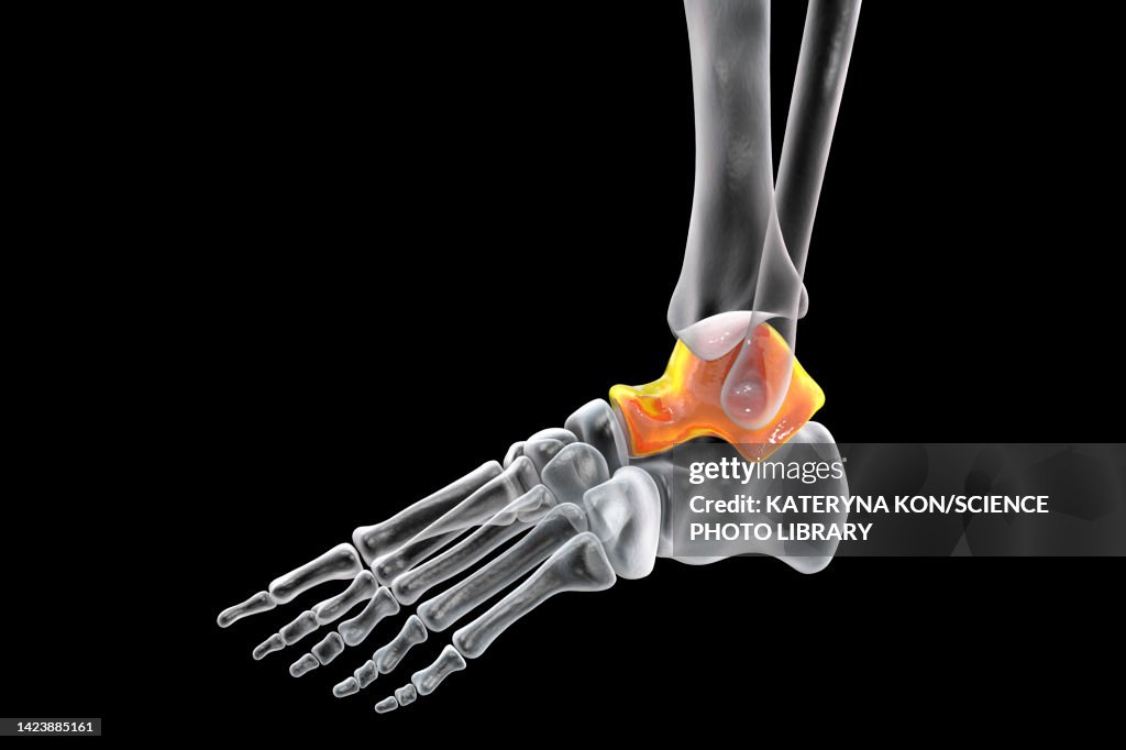Talus Diffusion Talus Bone Illustration High-Res Vector Graphic - Getty Images