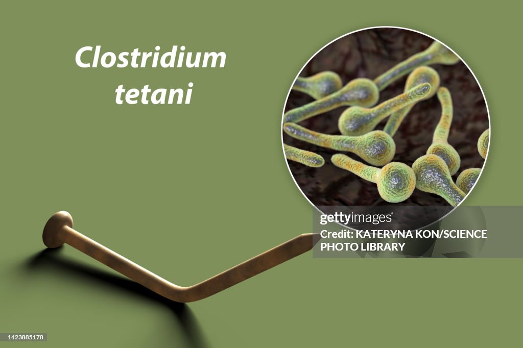 Tetanus Rivm Tetanus Transmission Conceptual Illustration High-Res Vector Graphic ...