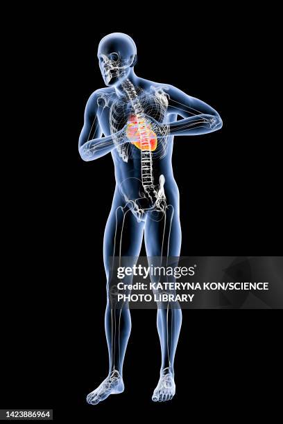 man with chest pain, illustration - heartburn stock illustrations