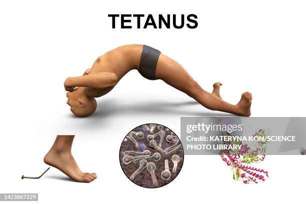 mechanism of tetanus disease, illustration - clostridium tetani stock illustrations