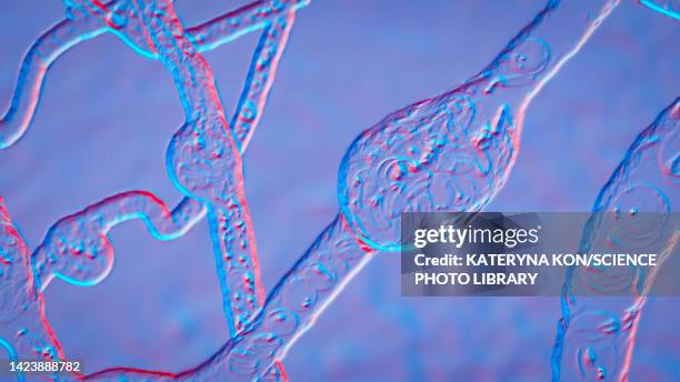 microaneurysms, illustration - eye disease stock illustrations