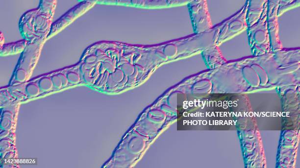 bildbanksillustrationer, clip art samt tecknat material och ikoner med microaneurysms, illustration - basal ganglia