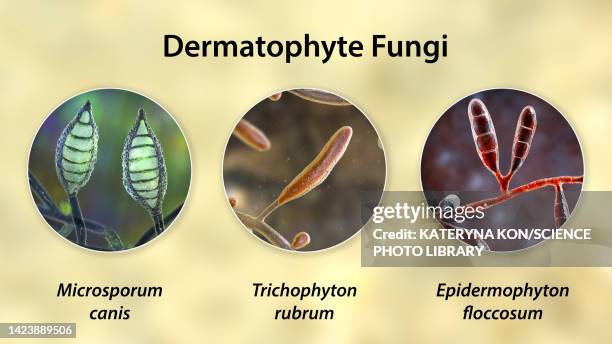 dermatophyte fungi, illustration - onychomycosis stock illustrations