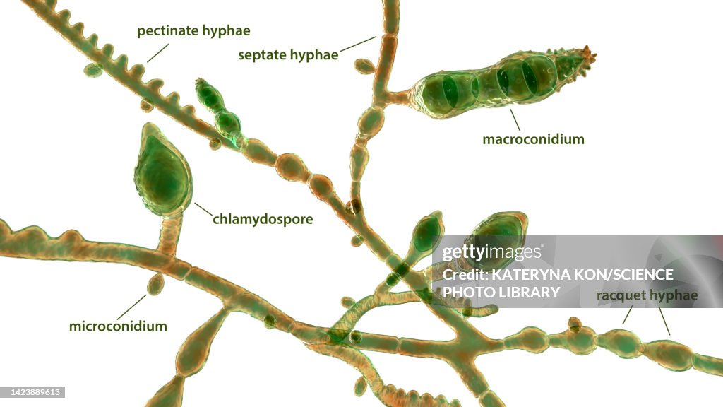 Microsporum audouinii fungus, illustration